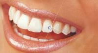 8-эстетическая стоматология